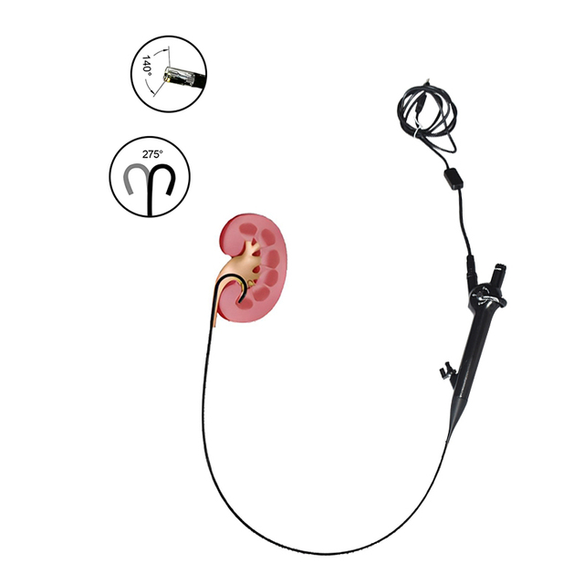 Ureteroscopio met&aacute;lico reutilizable para urolog&iacute;a el&eacute;ctrica HD, flexible