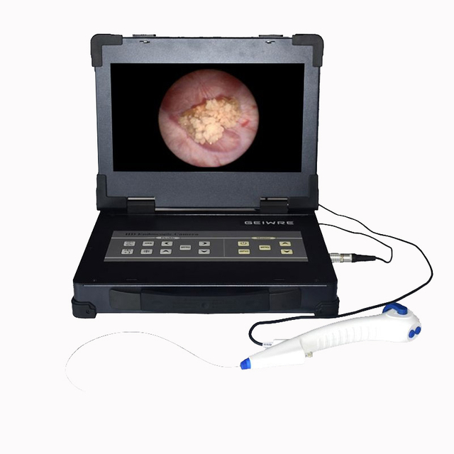 133 Sistema di telecamere per endoscopio integrato+endoscopio flessibile