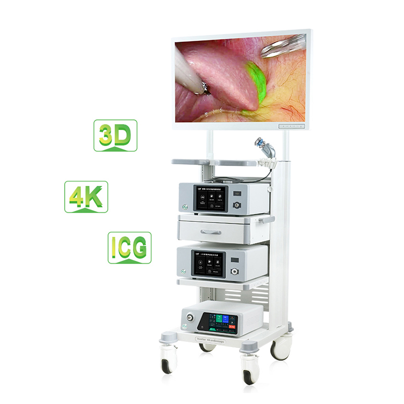  Telecamera per endoscopio chirurgico a fluorescenza 4K Torre completa per laparoscopia per chirurgia tumorale