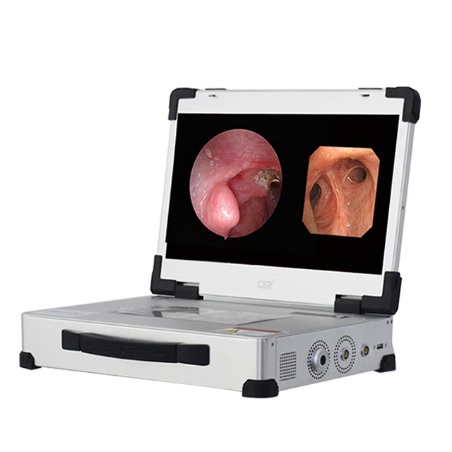 C&aacute;mara endosc&oacute;pica flexible r&iacute;gida integrada con junta de espejo dual HD 3310