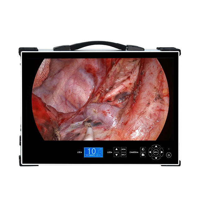 Endosc&oacute;pio m&eacute;dico port&aacute;til HD1080P de 24 polegadas